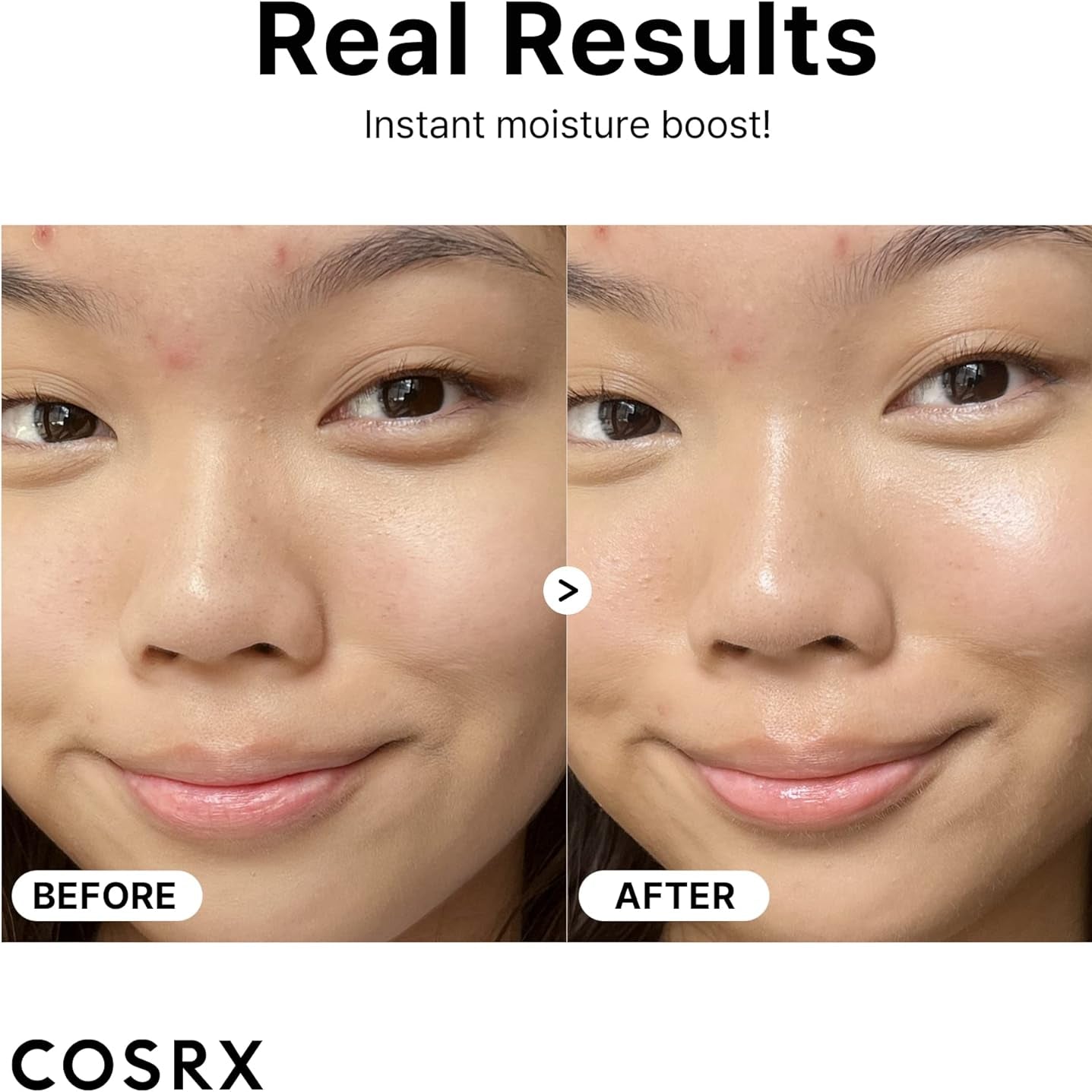 COSRX The Hyaluronic Acid 3 Serum