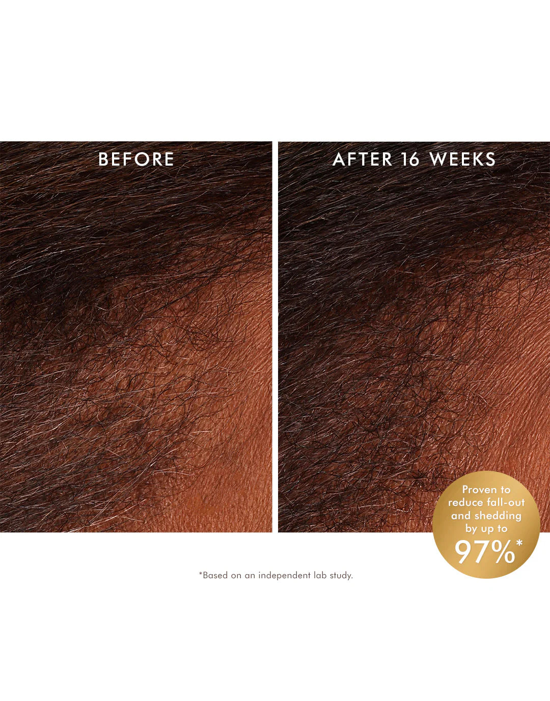 Moroccanoil Revitalizing Scalp Tonic 100ml