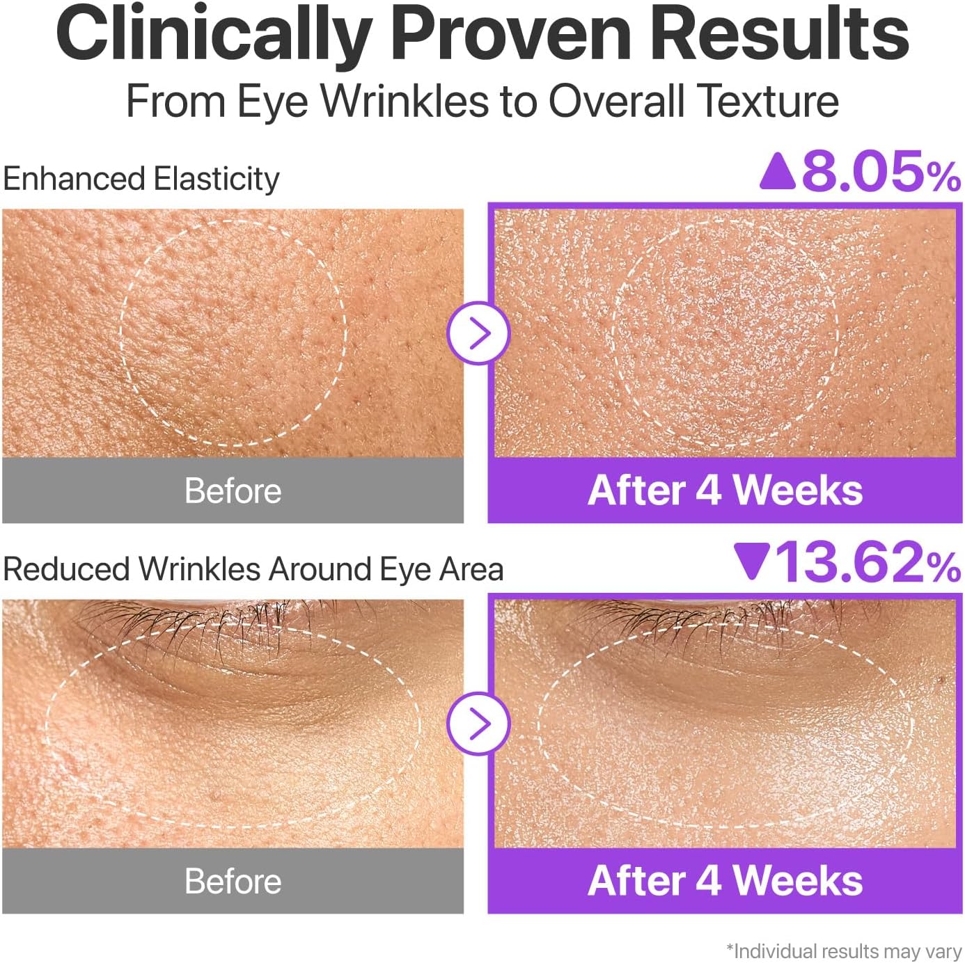 Numbuzin No.9+ NAD BIO Lifting-sil Essence 30ml