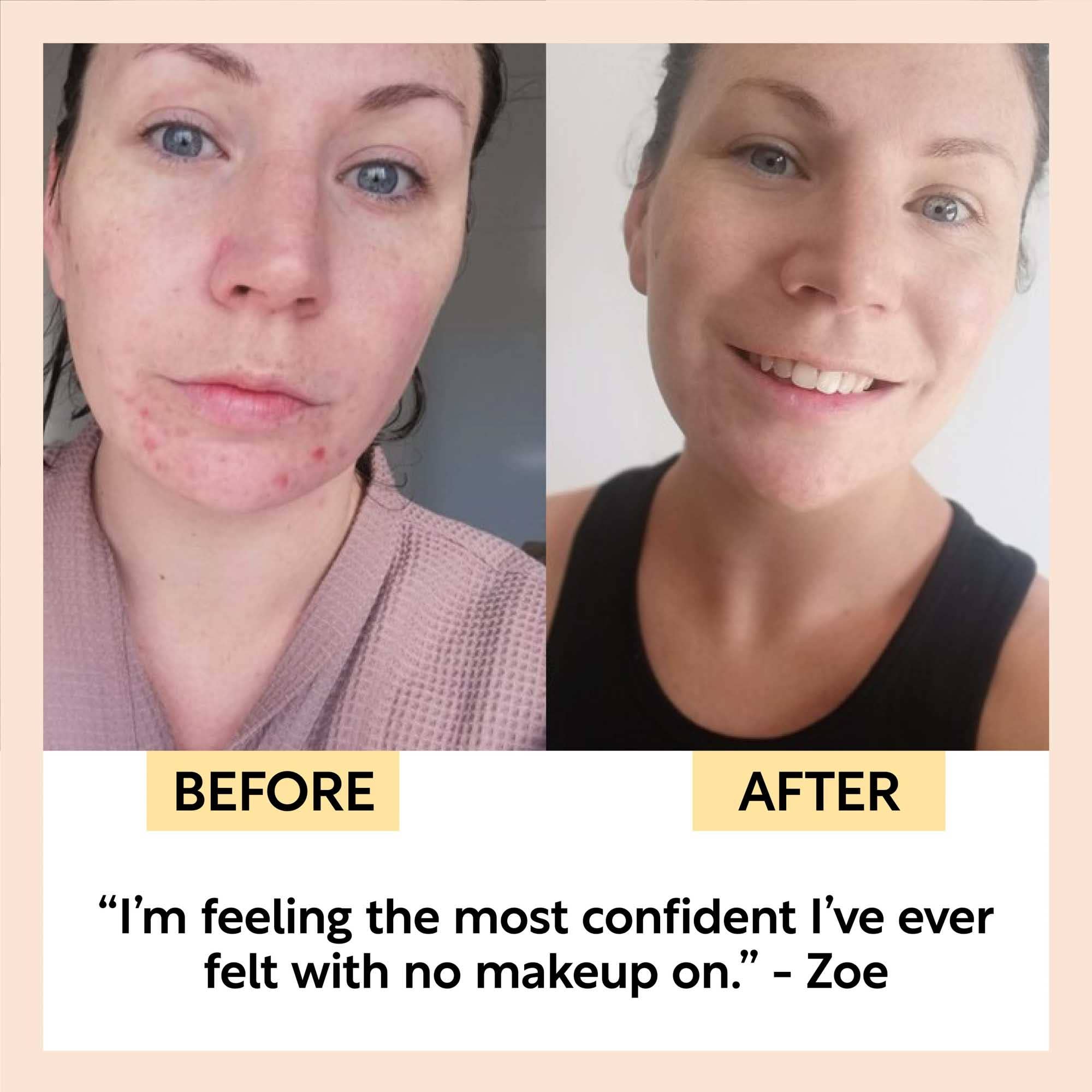 UpCircle SPF 25 Mineral Sunscreen