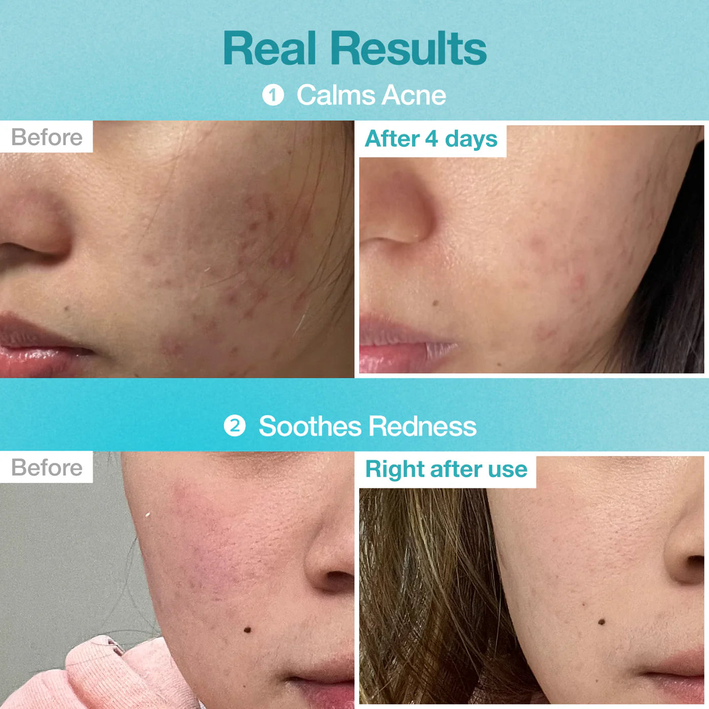 Numbuzin No.1 Pantothenic B5 Hyaluronic Active Clear Mask 1pc