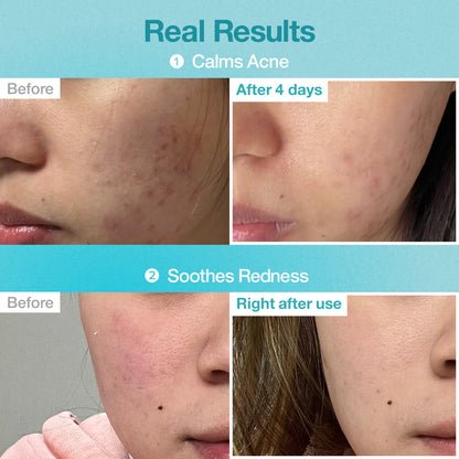 Numbuzin No.1 Pantothenic B5 Hyaluronic Active Clear Mask 1pc