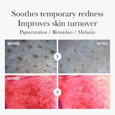 Medicube Red Succinic Acid Peeling Pad 70pads