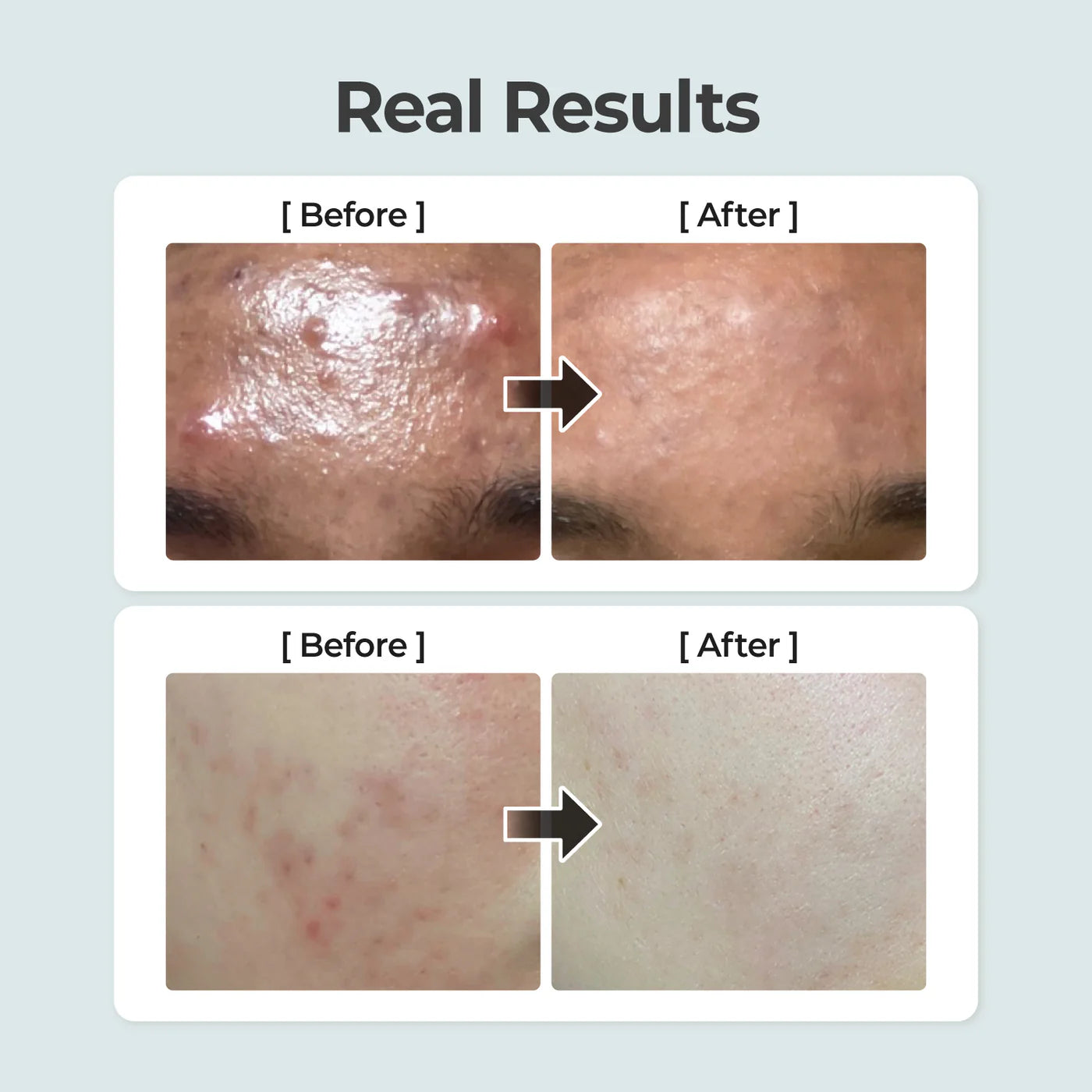 Numbuzin No.1 Pure-Full Calming Herb Toner 300ml