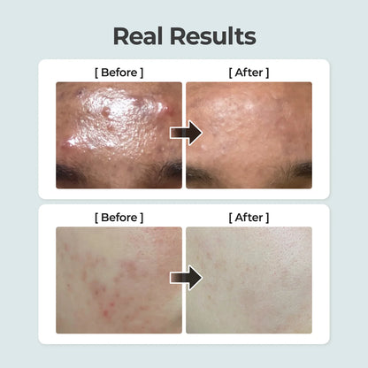 Numbuzin No.1 Pure-Full Calming Herb Toner 300ml