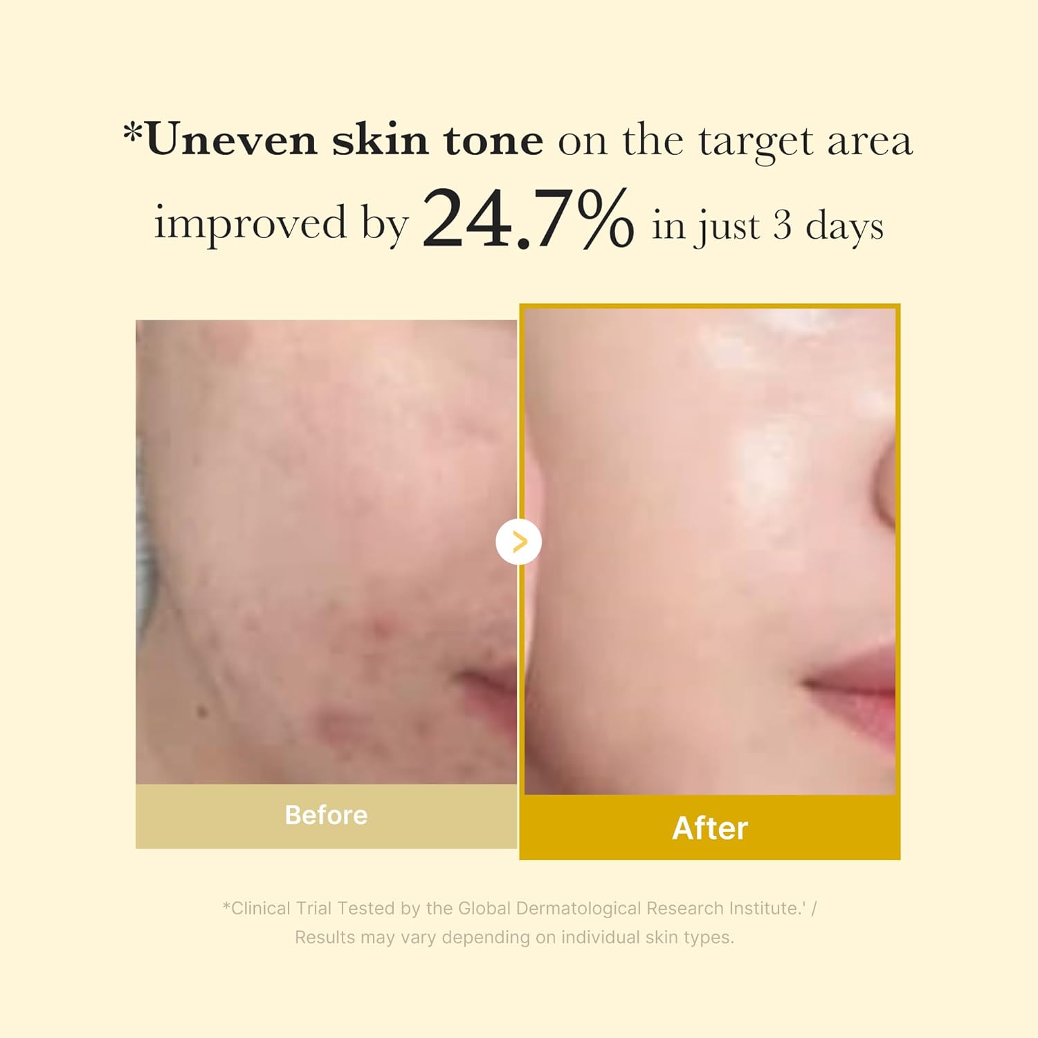 Medicube Kojic Acid Wrapping Mask 75ml
