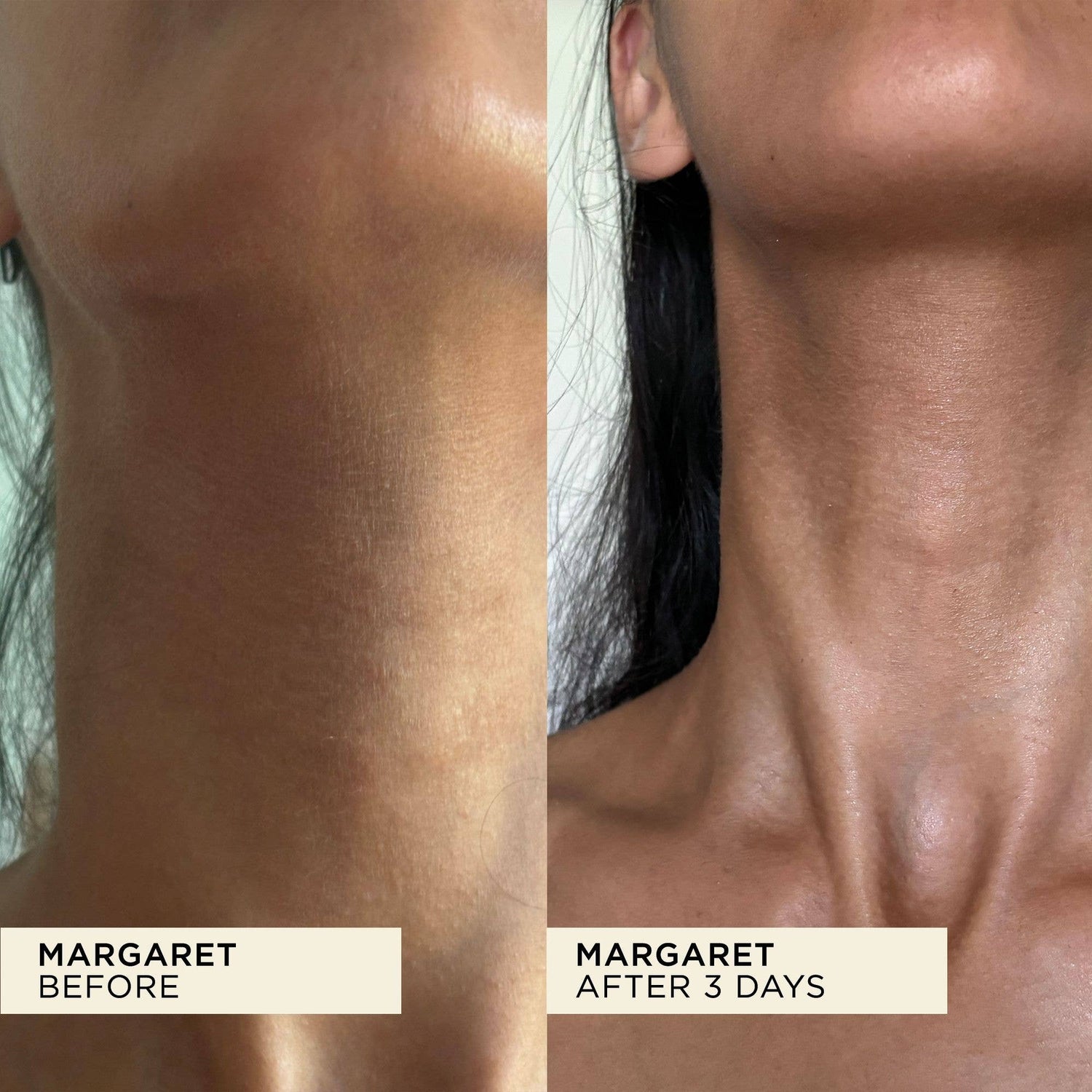 Wonderbalm Multi-Purpose Balm