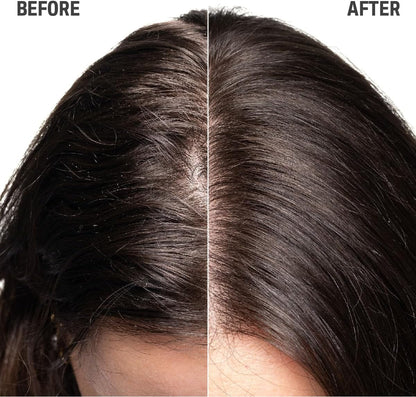 Goldwell Dualsenses Scalp Specialist Sensitive Foam Shampoo 250ml