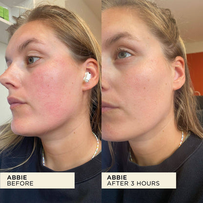 Wonderbalm Multi-Purpose Balm