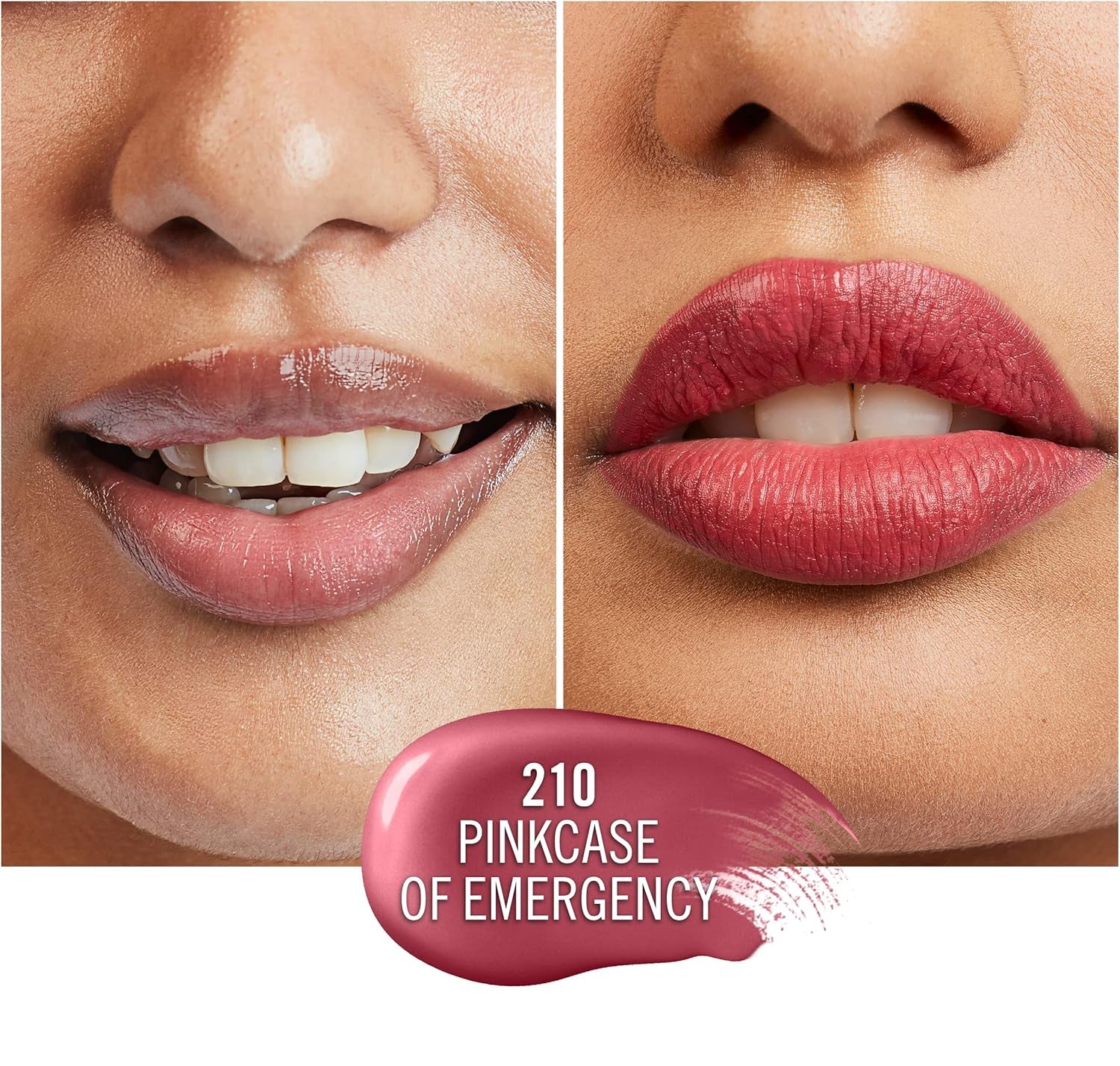 #colour_210-pinkcase-of-emergency