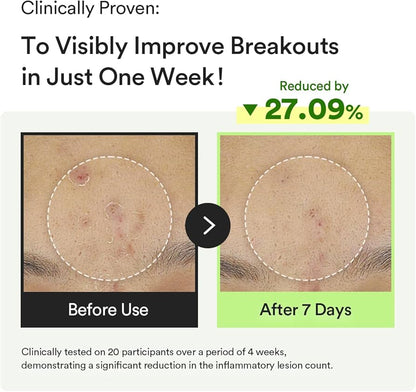 Abib Heartleaf TECA Capsule Serum Calming Drop 50ml