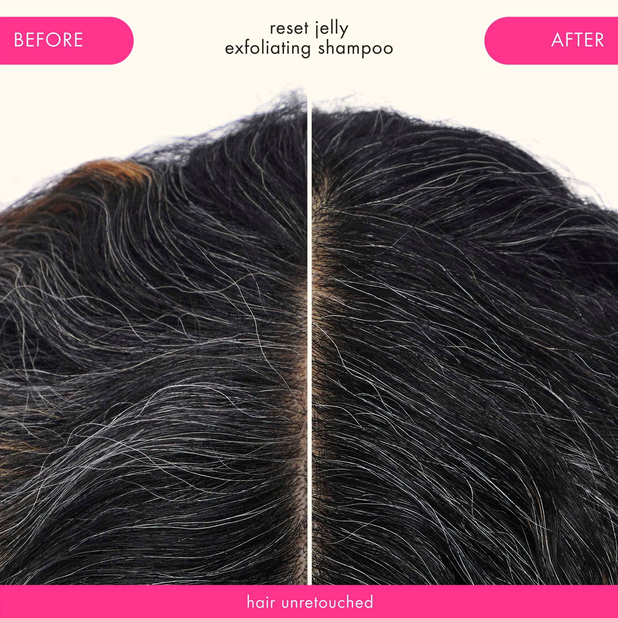Unretouched before-and-after scalp results after using Amika Reset Exfoliating Jelly Shampoo on dark hair.