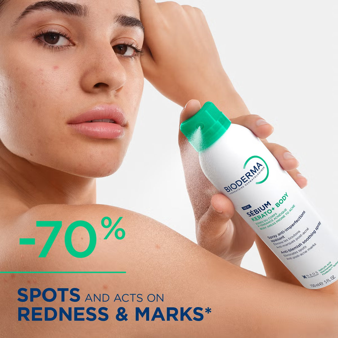 Bioderma Sebium Kerato+ Anti-Blemish Soothing Body Spray 150ml results