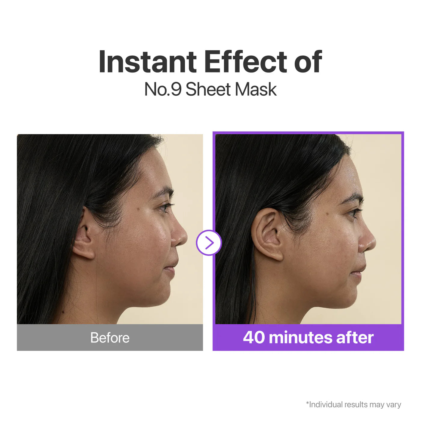 Numbuzin No.9 NAD+ BIO Lifting-sil Full Face Mask (4 Sheets + Lifting Band)