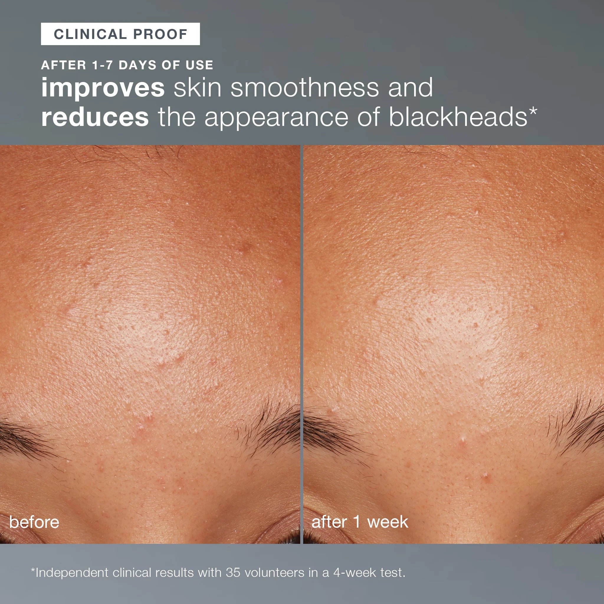 Dermalogica Daily Microfoliant - Brightening Rice Based Powder Exfoliant