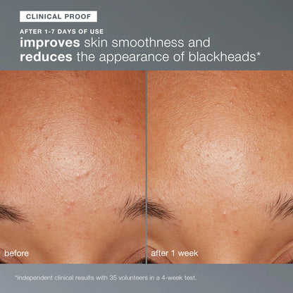 Dermalogica Daily Microfoliant - Brightening Rice Based Powder Exfoliant