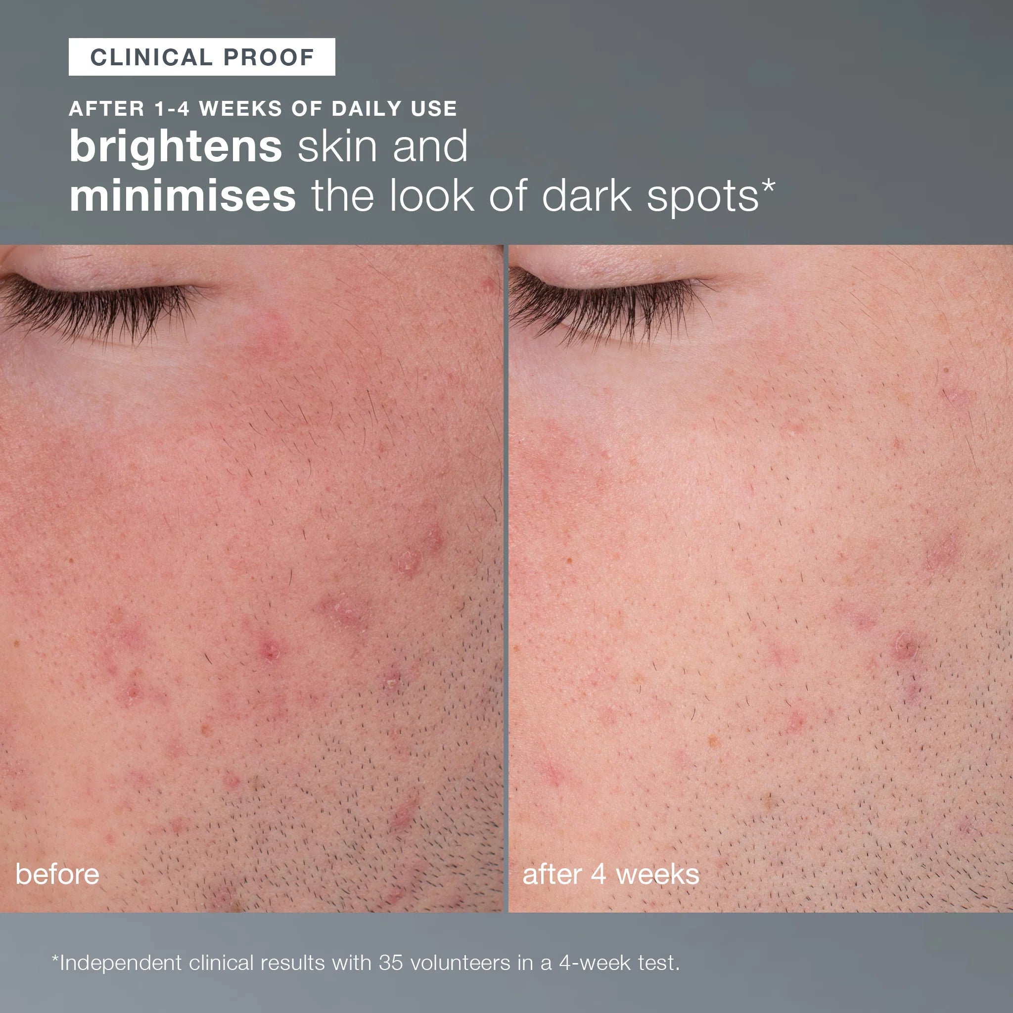 Dermalogica Daily Microfoliant - Brightening Rice Based Powder Exfoliant