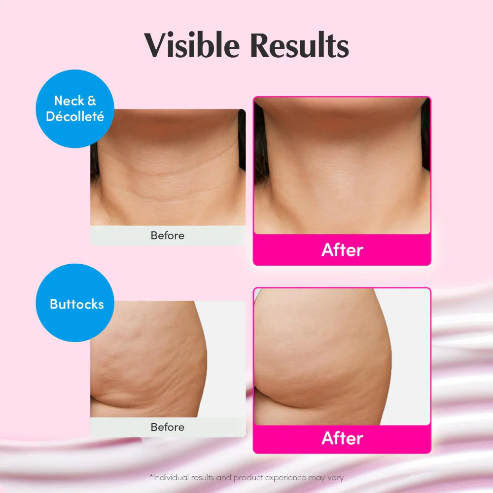 equalberry lush blush nad+ peptide boosting cream visible results on neck lines and right glute cellulite