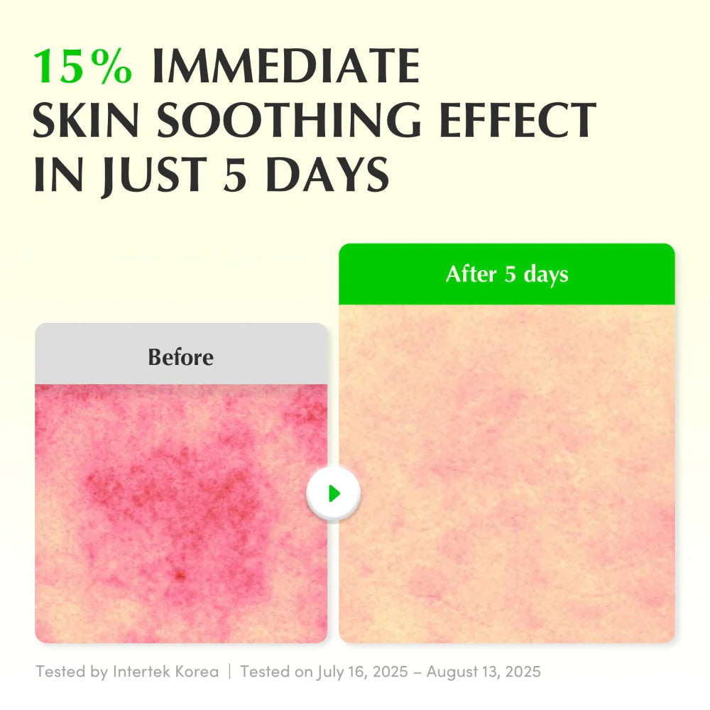 eqqualberry aloe pdrn serum 30ml before and after 5 days of use