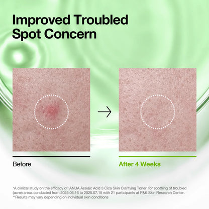 Anua Azelaic Acid 3 Cica Skin Clarifying Toner 250ml