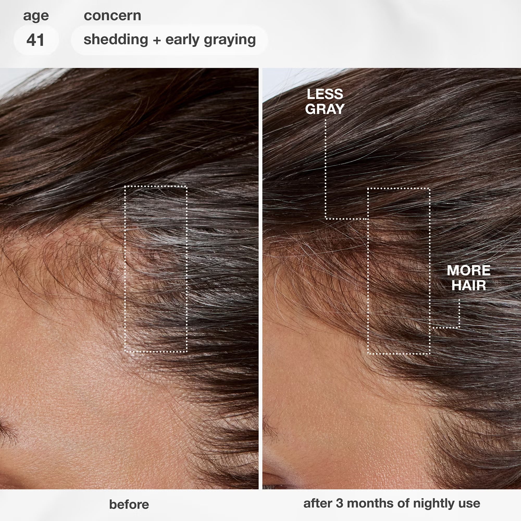 K18 Future IQ before and after results showing visibly thicker hair and fewer grey hairs after 3 months of nightly use, age 41.
