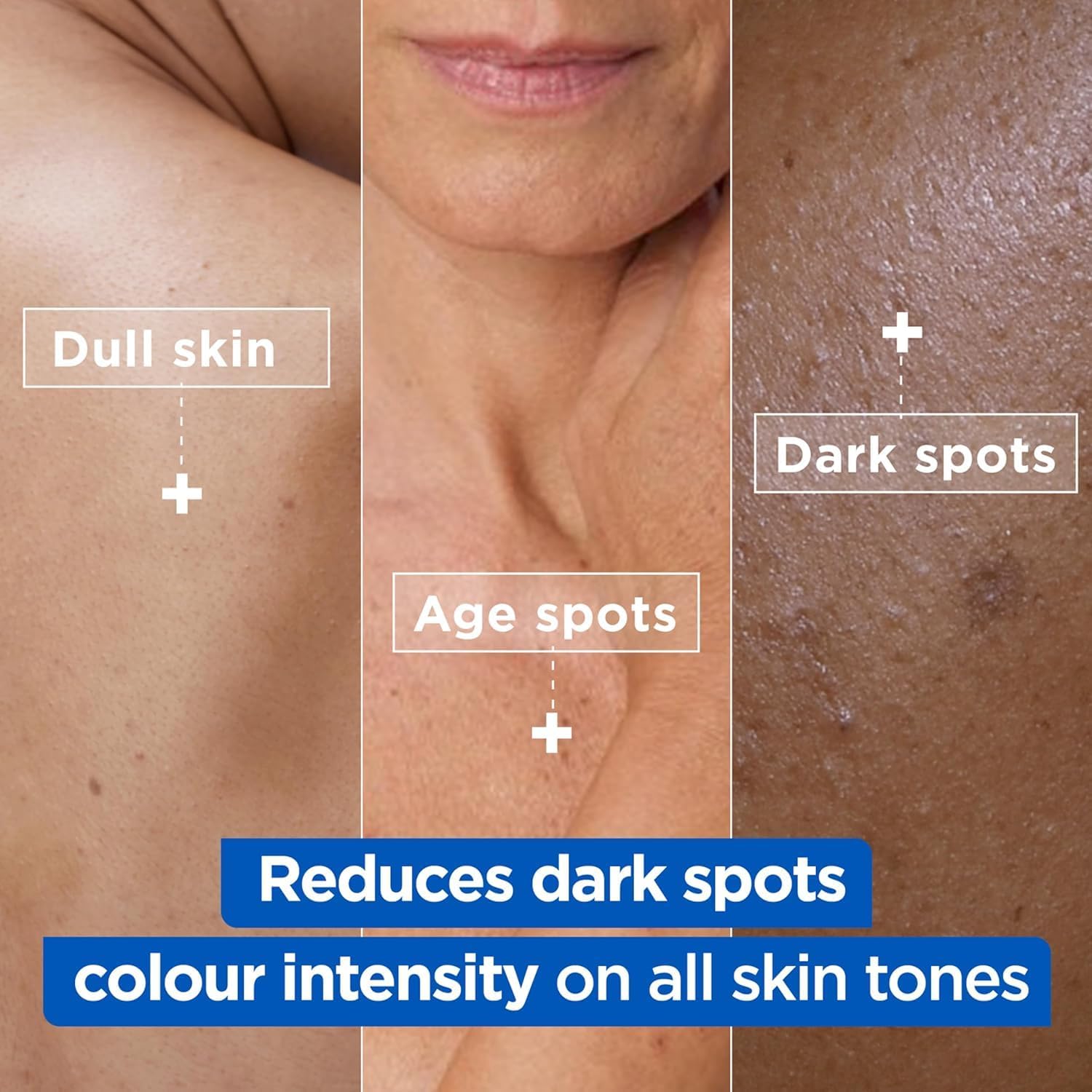Mixa Niacinamide Bright Moisturising Anti-Dark Spot Cream 400ml