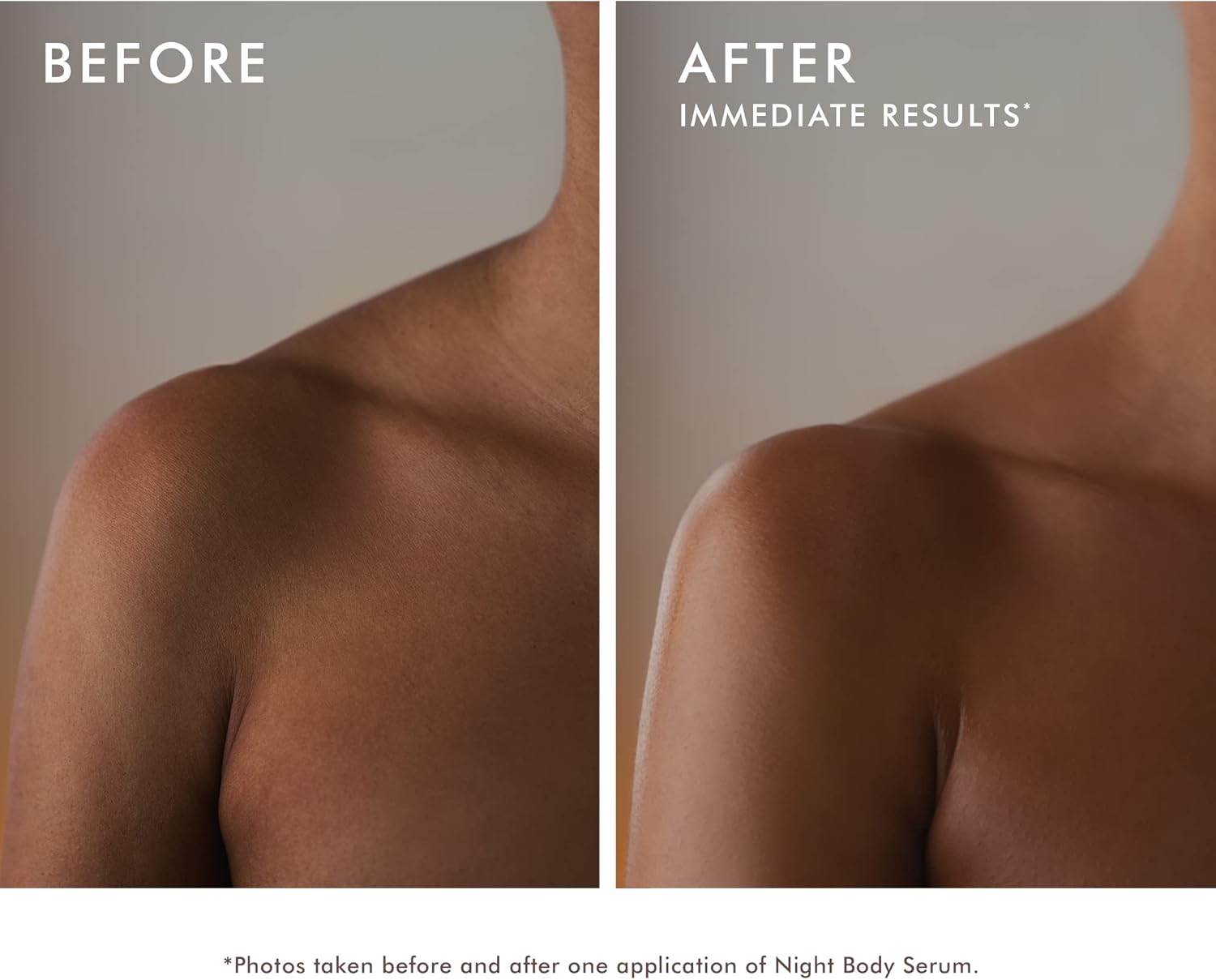 Before and after comparison showing visible improvement in shoulder skin after one application of Moroccanoil Night Body Serum, with smoother, firmer, and more radiant-looking skin.