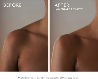 Before and after comparison showing visible improvement in shoulder skin after one application of Moroccanoil Night Body Serum, with smoother, firmer, and more radiant-looking skin.