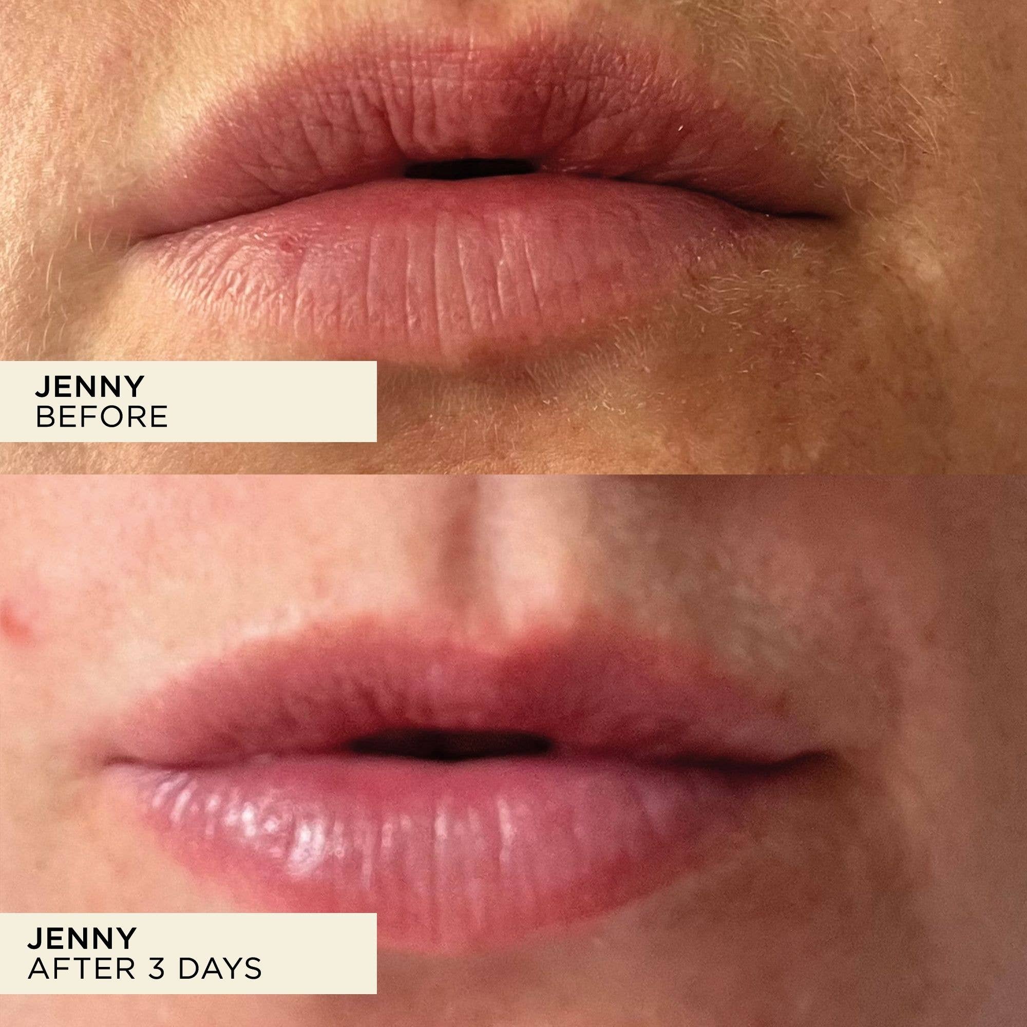 Wonderbalm Lip Balm 10ml