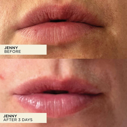 Wonderbalm Lip Balm 10ml