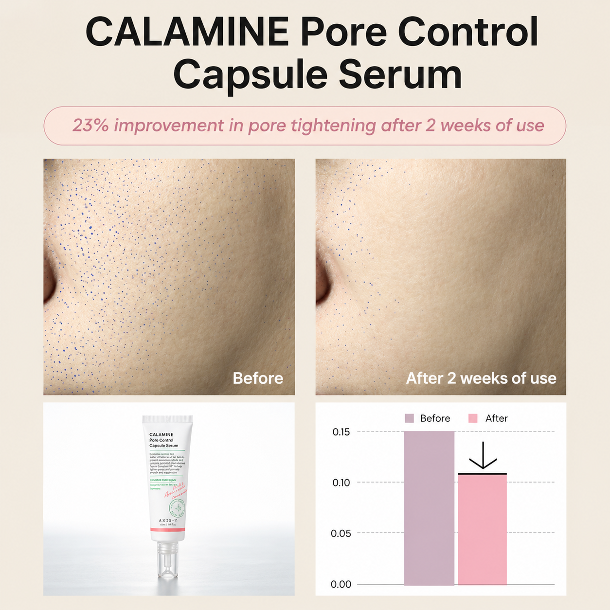infographic showing axis-y calamine pore control capsule serum before and after 2 weeks of use with pore-tightening comparison images, product photo and improvement chart on a light beige background