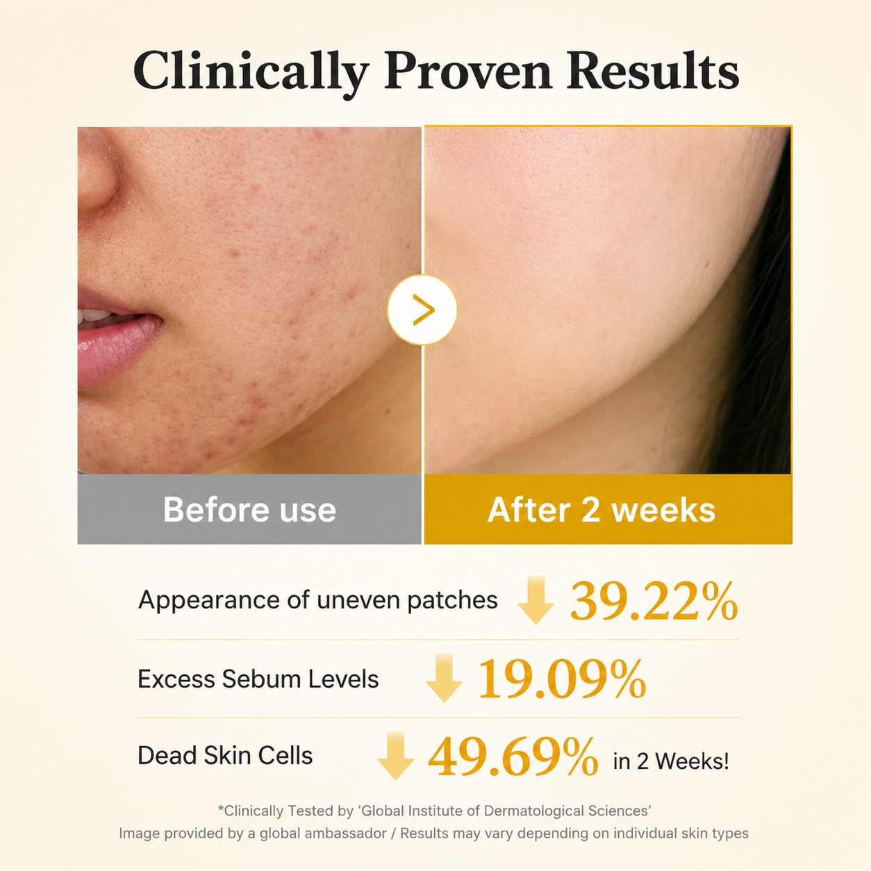 before and after skincare comparison showing visibly clearer skin after 2 weeks, with clinical results highlighting reductions in uneven patches, excess sebum, and dead skin cells