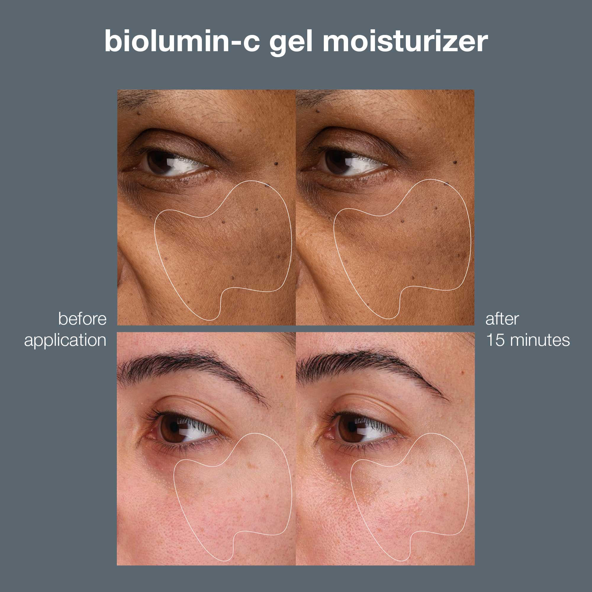 Dermalogica Biolumic-C Gel Moisturizer 50ml