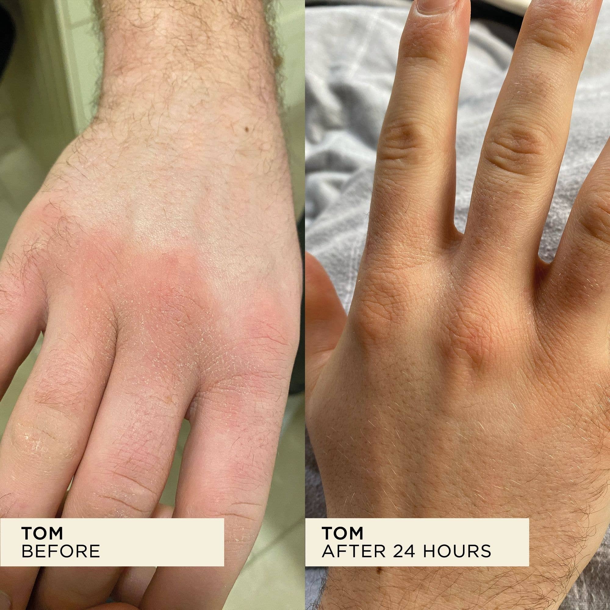 Wonderbalm Multi-Purpose Balm