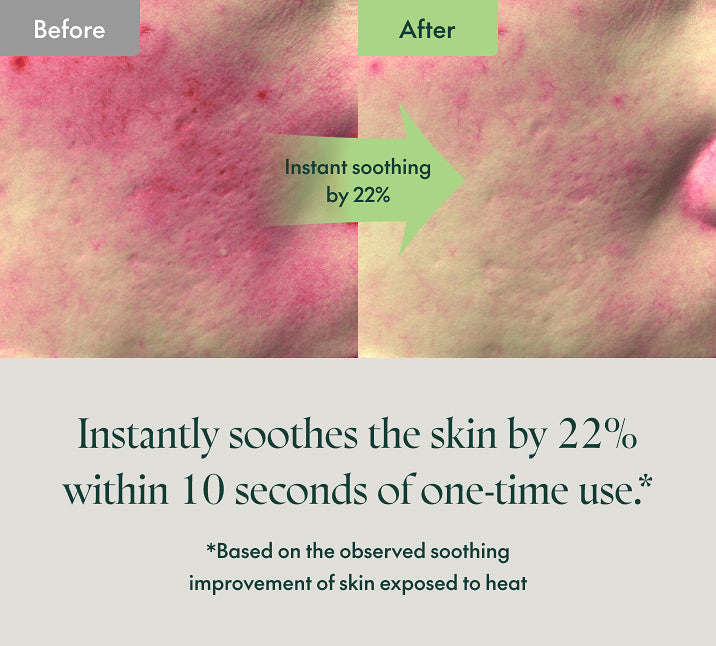 Before and after comparison of skin with a product applied, showing instant soothing effect.