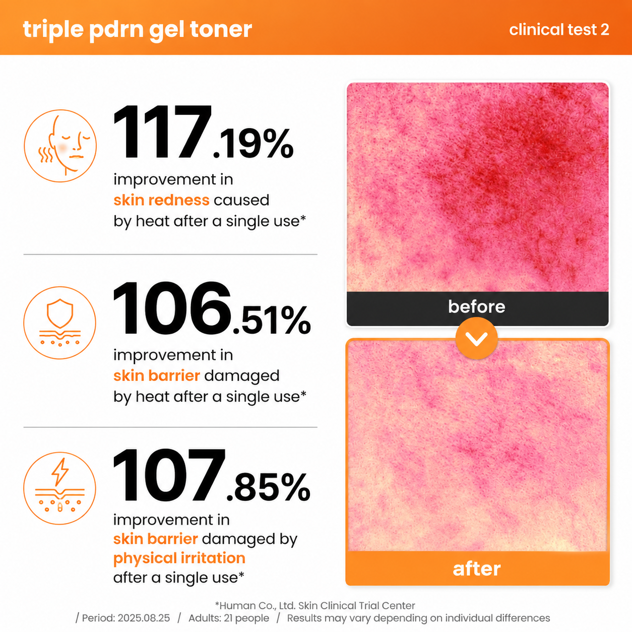 clinical test infographic for the axis-y triple pdrn gel toner showing before and after skin comparison images alongside clinical results. highlights a 117.19% improvement in heat-induced skin redness, a 106.51% improvement in heat-damaged skin barrier, and a 107.85% improvement in skin barrier affected by physical irritation after a single use, based on a clinical study involving 21 adults.
