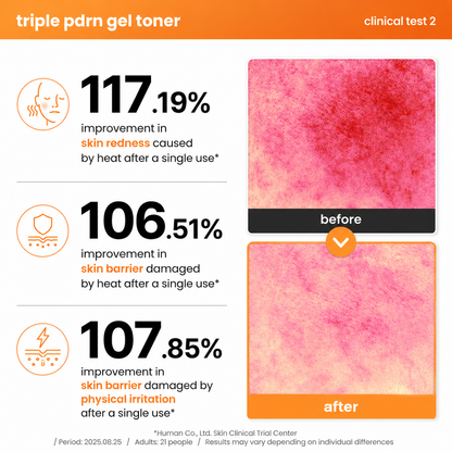 clinical test infographic for the axis-y triple pdrn gel toner showing before and after skin comparison images alongside clinical results. highlights a 117.19% improvement in heat-induced skin redness, a 106.51% improvement in heat-damaged skin barrier, and a 107.85% improvement in skin barrier affected by physical irritation after a single use, based on a clinical study involving 21 adults.