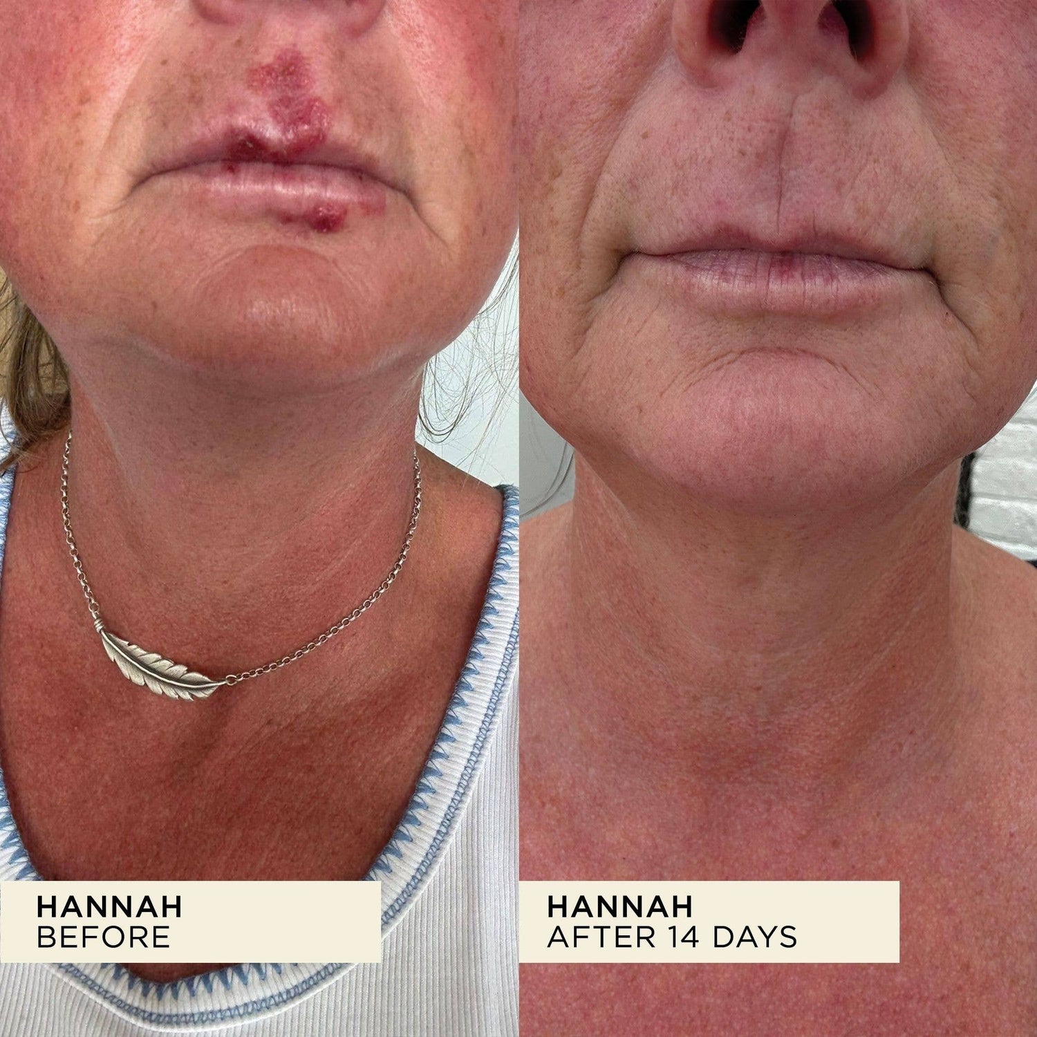 Wonderbalm Multi-Purpose Balm