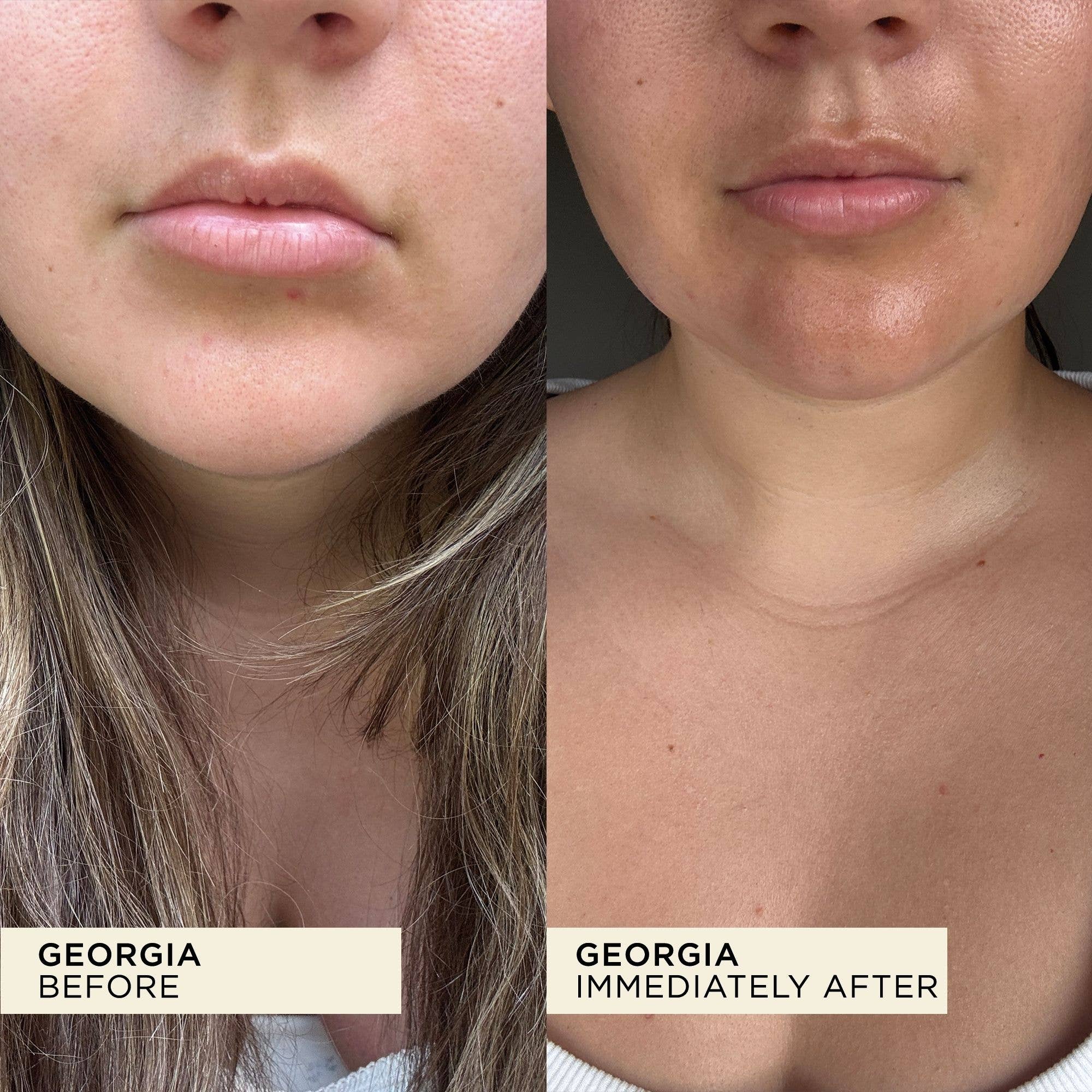 Wonderbalm Lip Balm 10ml