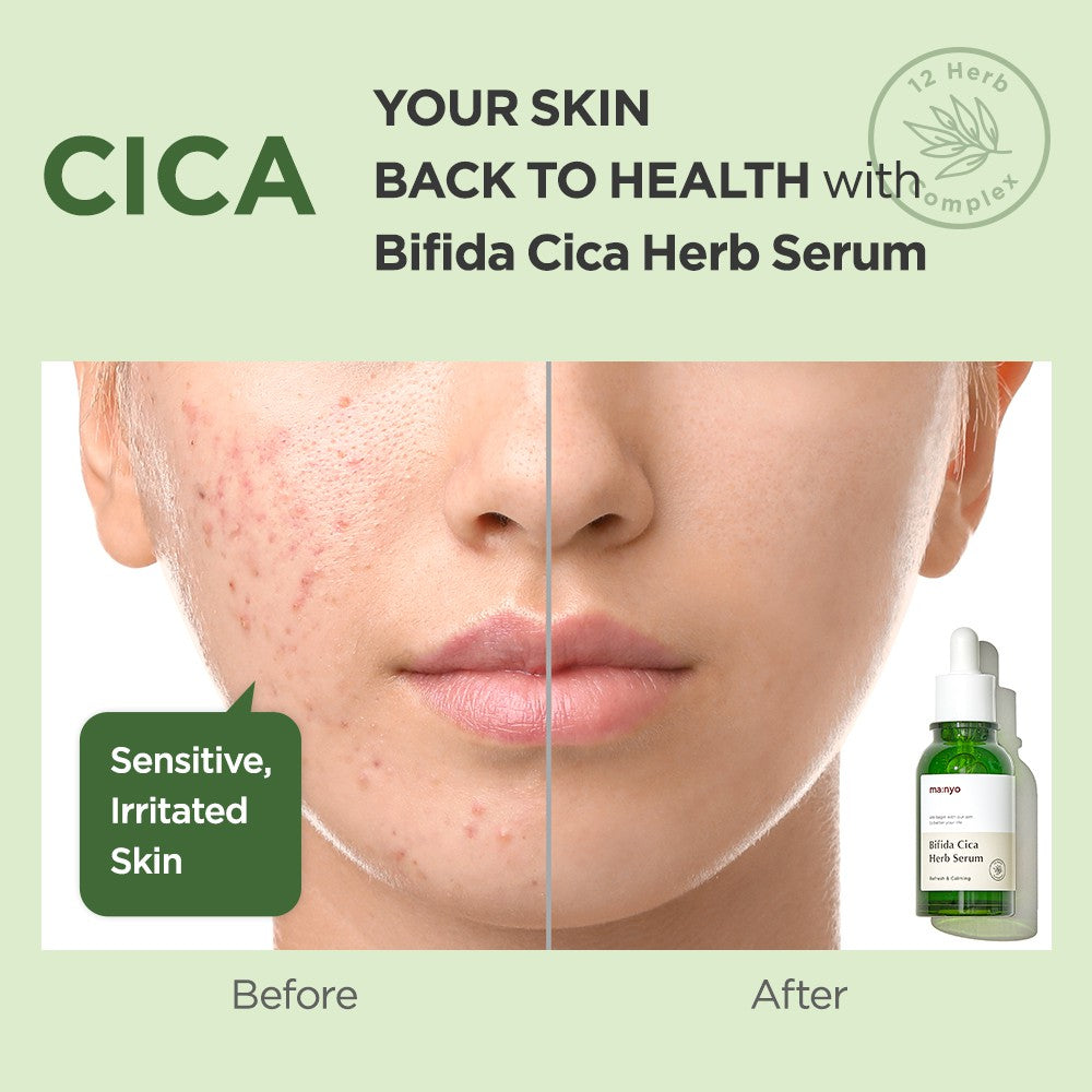 Ma:nyo Bifida Cica Herb Serum 50ml