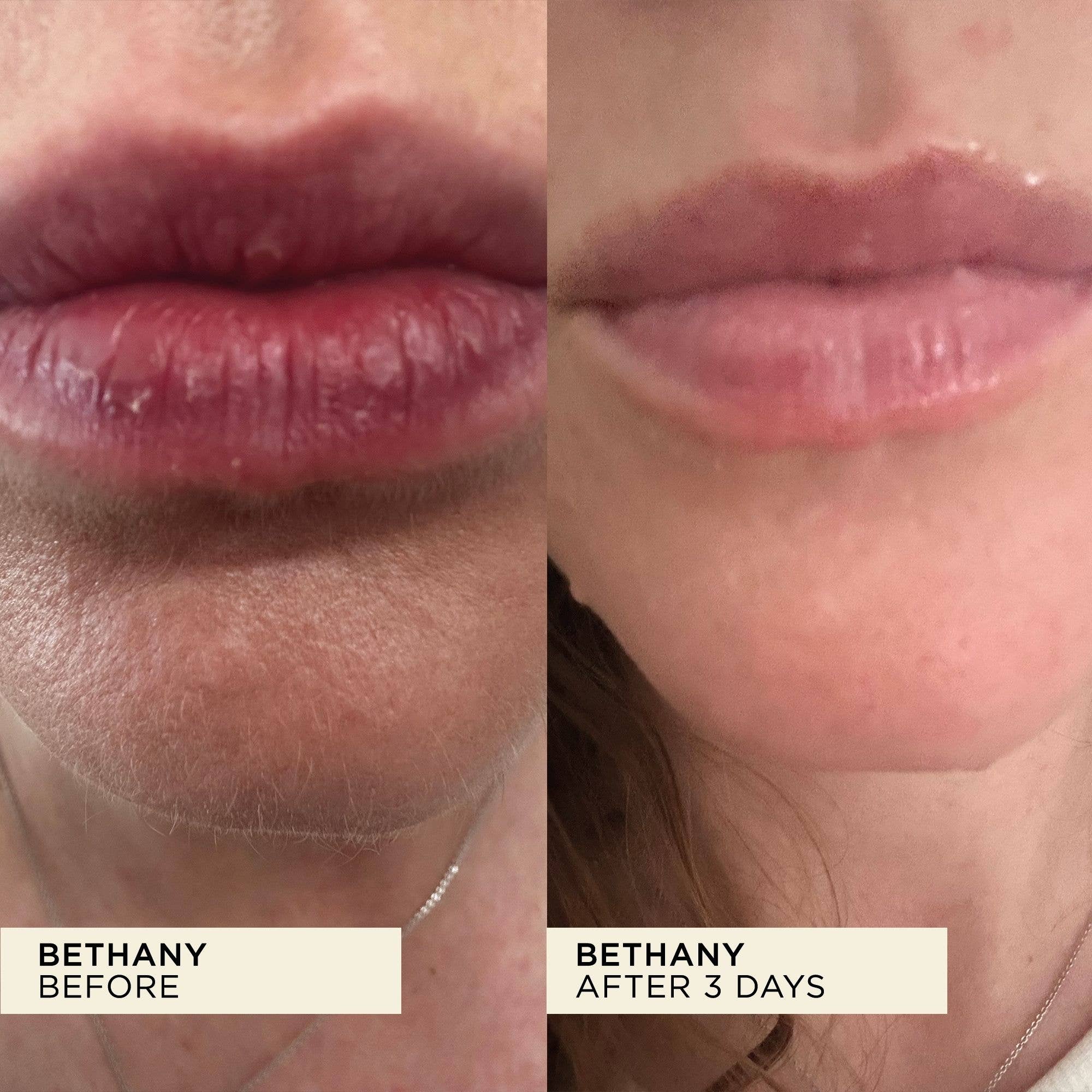 Wonderbalm Lip Balm 10ml