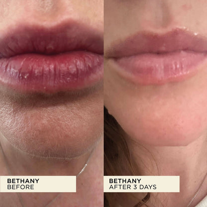 Wonderbalm Lip Balm 10ml