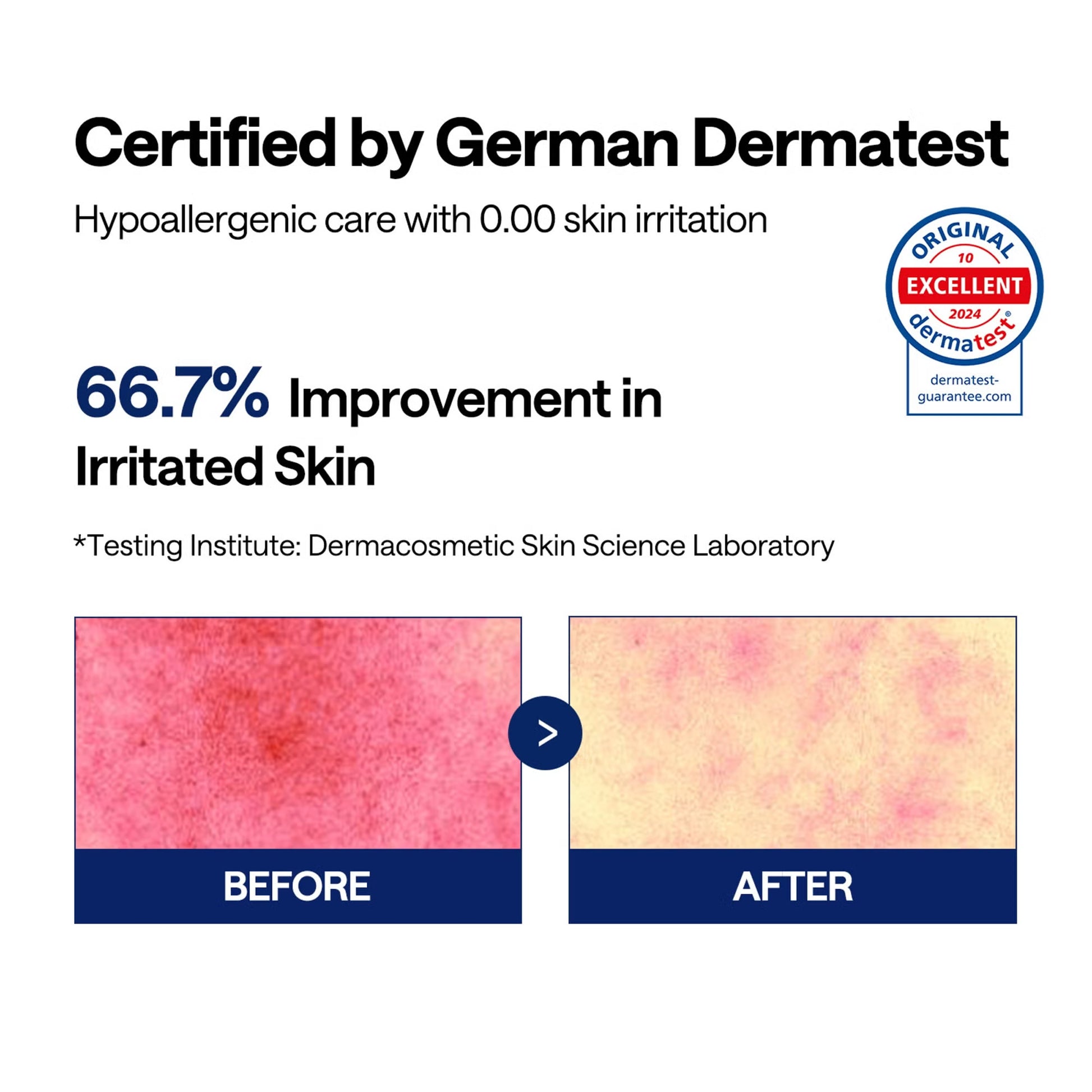 MEDIHEAL Teatree Trouble Pads 100 Pads irritated skin improvement infographic