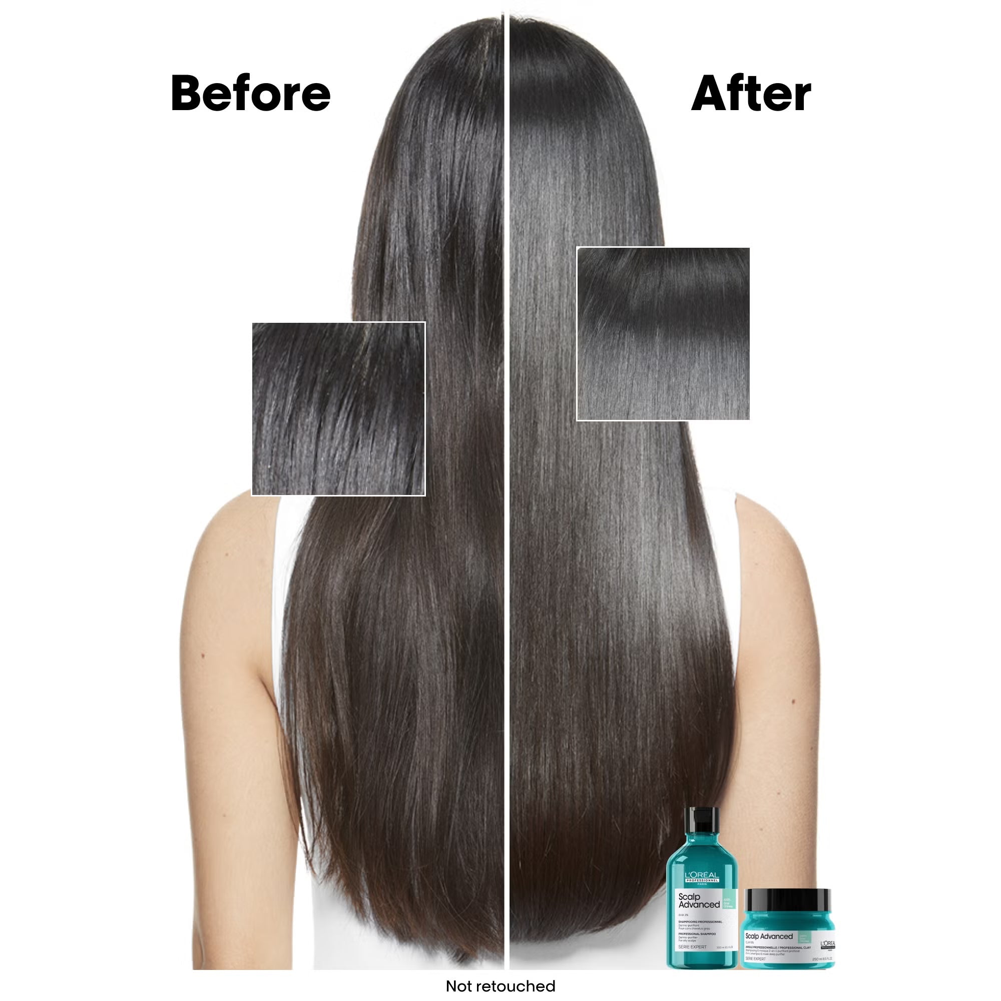 L'Oreal Professionnel Scalp Advanced Anti-Oiliness Shampoo