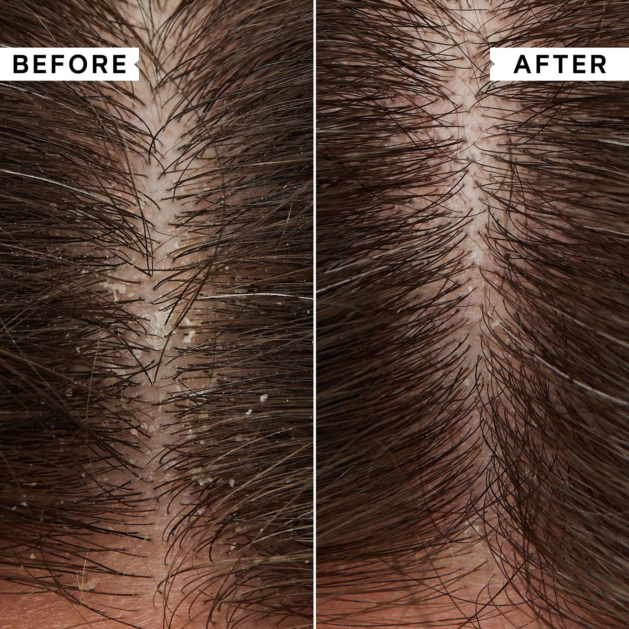 Phillip Kingsley Flakey / Itchy Scalp Toner