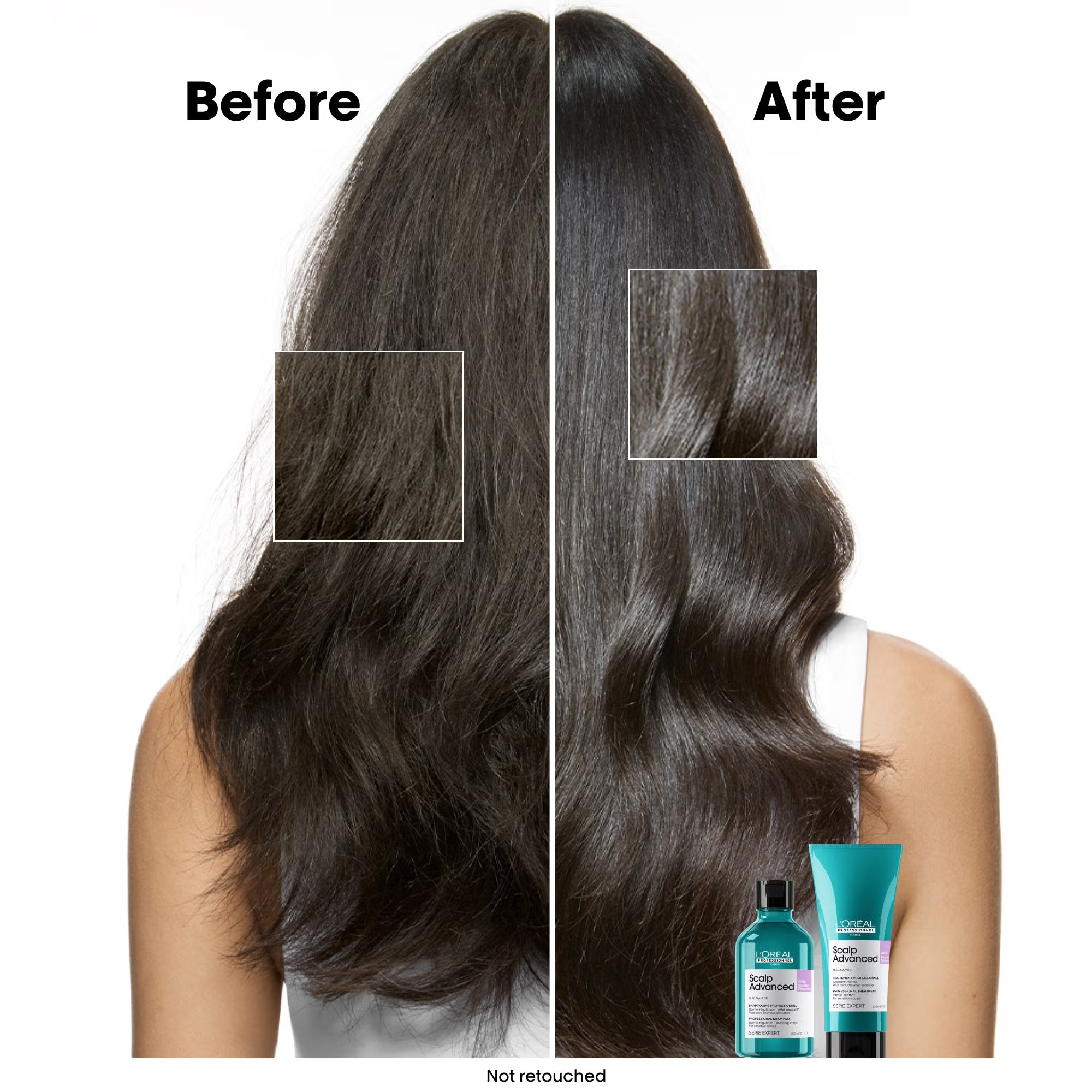 L'Oreal Professionnel Scalp Advanced Anti-Discomfort Shampoo