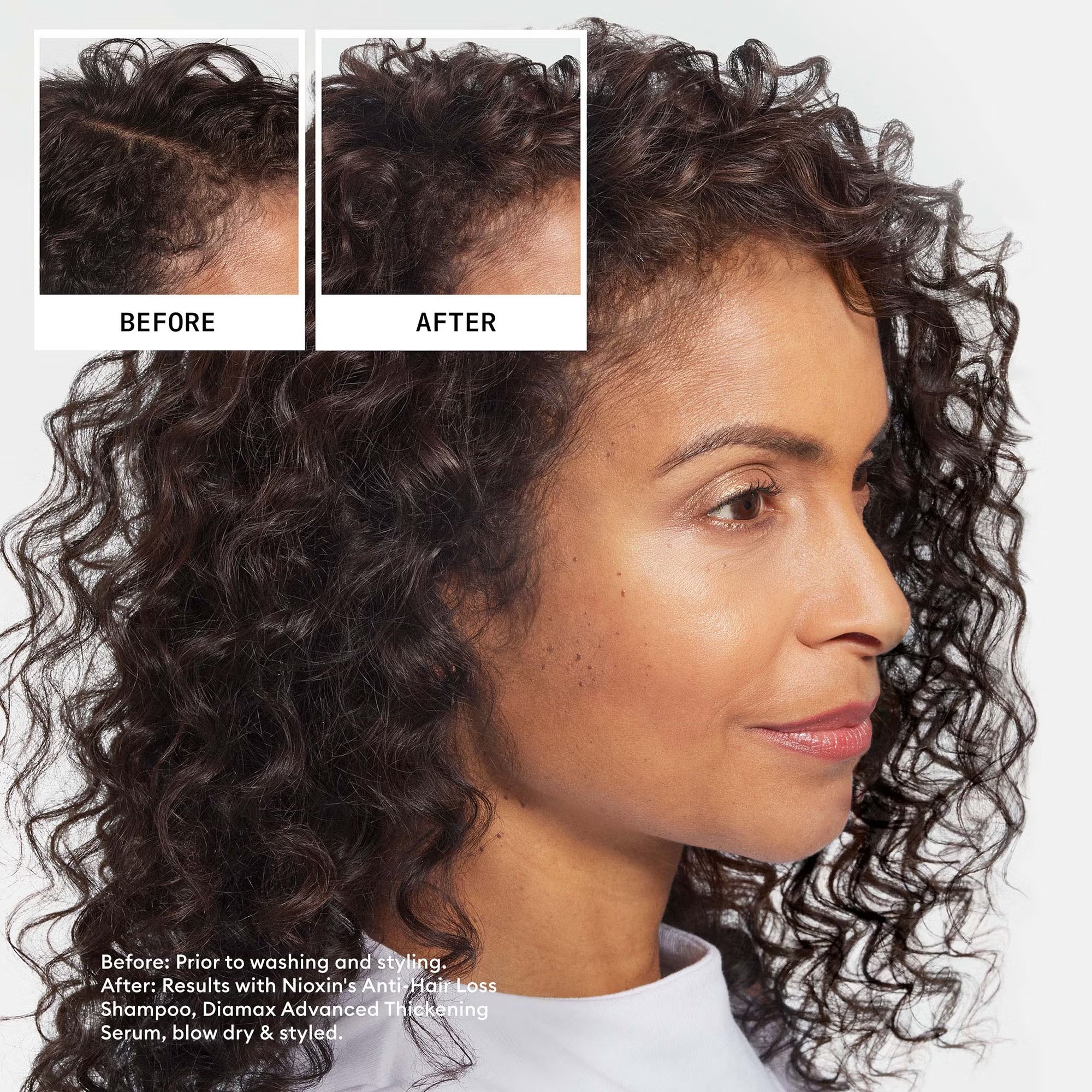 Nioxin Anti-Hair loss Shampoo 240ml