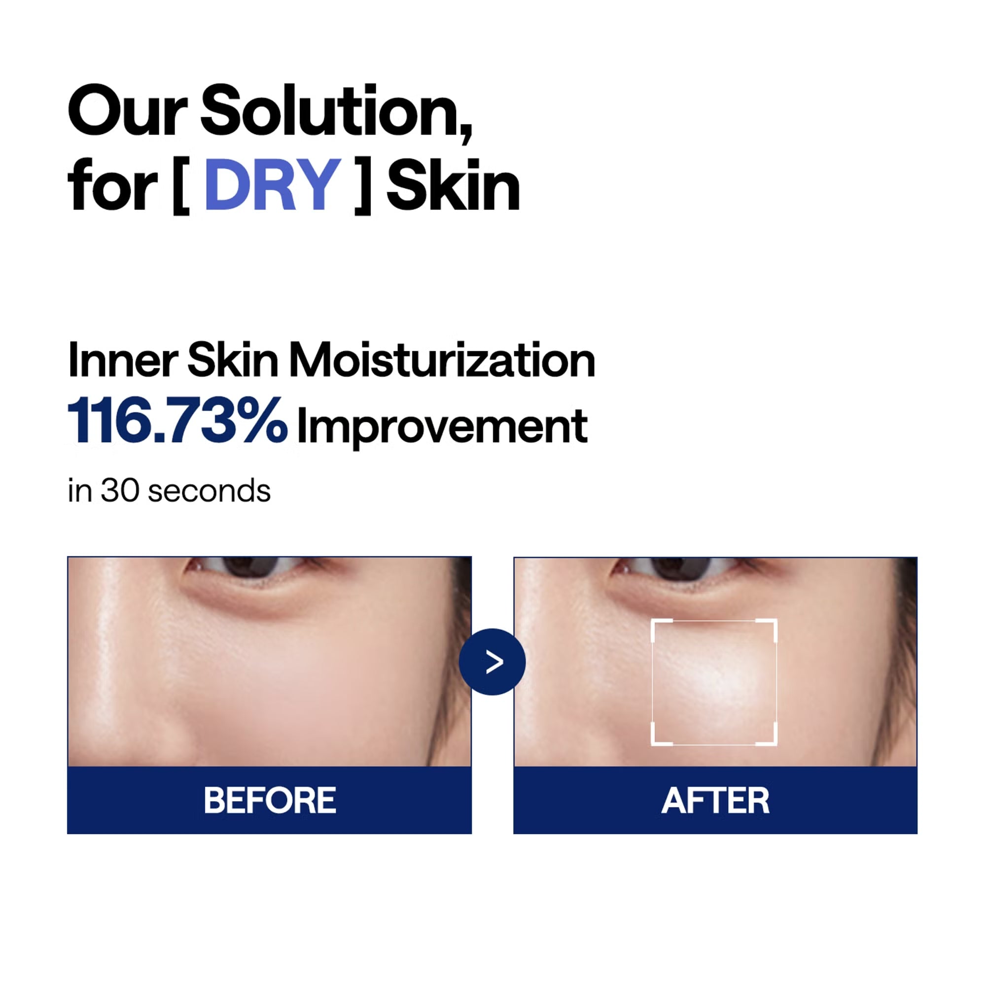 MEDIHEAL Watermide Moisturise Pad 100 Pads